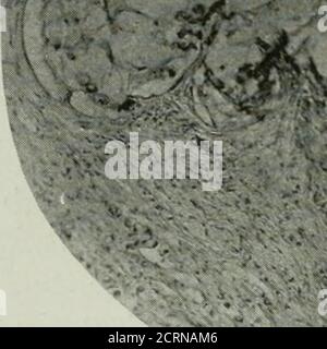 . Die amerikanische Zeitschrift für Roentgoenology, Radium-Therapie und Nuklearmedizin . Stockfoto