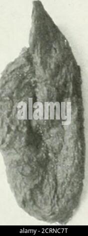 . Die amerikanische Zeitschrift für Roentgoenology, Radium-Therapie und Nuklearmedizin . Stockfoto