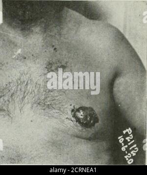 . Die amerikanische Zeitschrift für Roentgoenology, Radium-Therapie und Nuklearmedizin . Stockfoto