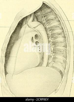 . Grundriss der Lungenchirurgie . ist, der durch den Ueber-Gang der pleura sternocostalis an der hinteren Fläche des Sternums in dasMittelfell bildet. Während hier die rechte Lunge zur Zeit derInspiration die Pleurahöhle fast komplett ausfüllt, bleibt links, ent-sprechend der Incisura cardiaca der linken Lunge (s. unten) in derHöhe des 4. Und 5. Rippenknorpels ein Abschnitt des Pleuraüberzogenen Herzbeutels von Lunge unbekannt, Diese Stelle spricht absolute Herzschwäfung. 14 C. Garre. Eine besondere Besprechung erheischen endly die Brustfei 1-liuppeln, welche von den Lungens Stockfoto