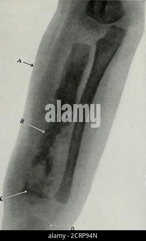 . Lebende Anatomie und Pathologie; die Diagnose von Krankheiten im frühen Leben durch die Roentgen-Methode . ABB. 2. /^t ABB. 3. Stockfoto