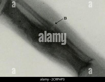 . Lebende Anatomie und Pathologie; die Diagnose von Krankheiten im frühen Leben durch die Roentgen-Methode . Icfe -41 Stockfoto