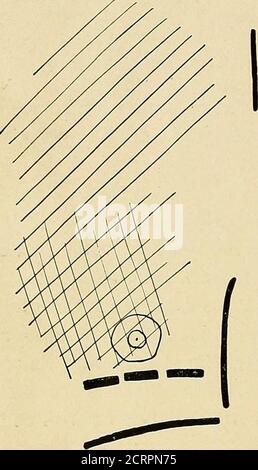 . Die Roentgen Strahlen in der Medizin und Chirurgie als Hilfsmittel in der Diagnose und als therapeutisches Mittel: Für den Einsatz von Praktikern und Studenten konzipiert. Mai 189S. Körperliche Untersuchung. - Lungen normal, außer dass die Atmung war etwas ruckig an Orten, und der Fremitus leicht über der ganzen rechten Brust erhöht. Rest der körperlichen Untersuchung noch-mal. Diagnose : Phthisis. Mai 13. Am inneren Rand der linken Scapula ein paar Rales; kein Differencein fremitus oder Stimme. Mai 14. Eine gelegentliche unbestimmte Rale hier und dort Überbrust, nicht permanent im Charakter; keine Anomalie im Atmen oder Stimme; resona Stockfoto