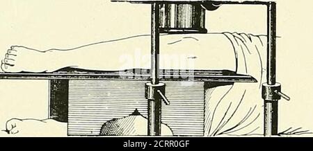 . Die Grundsätze und Praxis der roentgenologischen Technik . Abb. 245 Abb. 246 174 KNIE. Abb. 247 (Schönberg) Stockfoto