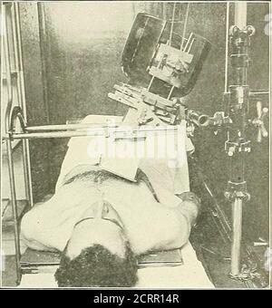 . Die Grundsätze und Praxis der roentgenologischen Technik . Abb. 23. 166 RÜCKENWIRBELSÄULE. Abb. 235 Stockfoto