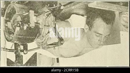 . Die Grundsätze und Praxis der roentgenologischen Technik . Abb. 232. – Röntgenaufnahme untere Halswirbel und obere Wirbelsäulenwirbel.. Abb. 233 Stockfoto