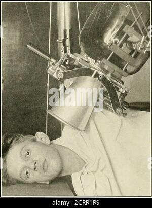 . Die Grundsätze und Praxis der roentgenologischen Technik . Abb. 228. – Extra-orale Methode.. Abb. 220 162 ZÄHNE EXTRAORAL Stockfoto