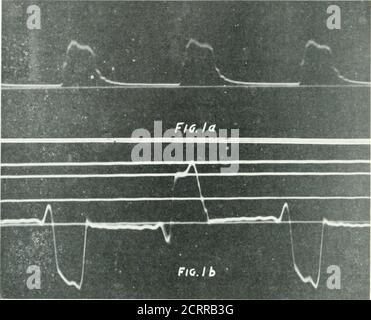 . Archive der Physikalischen Medizin und Rehabilitation . Da solche Dosierung im Menschen unmöglich ist. Wenn andererseits die Bleiöffnung auf 1 8 x 18 cm erhöht wurde. bei gleichbleibenden Bedingungen wurden alle Tumorzellen bei 240 min-uten Exposition oder 8.5 Erythemdosen auf die Haut abgetötet (Abb. L 175, S. 5) Dies ist immer noch ein ungünstiger Arbeitszustand, da es sich um Lichtportale handelt. Wenn, wie immer, die Haut-Fokus-Abstand geändert wird, wie es in einer anderen Serie war, auf 40 cm.instead von 30, der Tumor dann 50 Haltungen von geringem Atomgewicht, die cm. Aus der Antikathode erhalten wir eine WEITERE STUDIEN IX Stockfoto