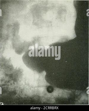 . Die amerikanische Zeitschrift für Roentgoenology, Radium-Therapie und Nuklearmedizin . Stockfoto