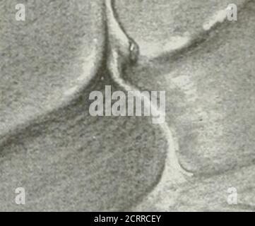 . Die amerikanische Zeitschrift für Roentgoenology, Radium-Therapie und Nuklearmedizin . Stockfoto