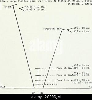 . Archive der Physikalischen Medizin und Rehabilitation . RM^. Abb. showi relativer Wert der vergrabenen Radiumemanation, des gefilterten Radiums von außen und der Hochspannungs-Röntgenstrahlen.die Prozentsätze beziehen sich auf die Erythemdosis an der Hautoberfläche aa 100. Infiltrierte Radiumemanationsdosen, die nur für -y-Strahlen berechnet werden. Radltun Factora: Filter, 2 mm. Messing durchmessend; Packungsdosis bei 15 cm. = 42.000 mc. Std.; bei 10 cm --- 20.000 mc. Std.; bei 6 cm. = Lo.OO mc. Std. Trav. Dosis bei 3 cm = 2200 mc. Std. 3 SCXLE-ITRE, bei W ooo. = 640 ma. Mltfat 50 cm. 3 330 ma. Kin. o tion an 8 Punkten Abb. 6 – Diagramm mit relativem Wert von buri Stockfoto