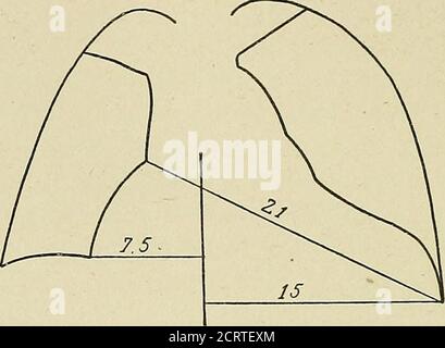 . Das Herz und die Aorta; Studien in der klinischen Radiologie . Symptome wurden durch Radioskopie aufgedeckt, Fälle, in denen Herzschwelligkeit gekennzeichnet war, außerdem durch die Modifikation und Retardierung von Pulsationen entlang der ventrikularen Konturen, durch Flaccidness, und leichte Amplitude der myo-Cardial Kontraktionen, oder kurz durch den Nachweis von severdisturbances in der Herzsystole. Myokardveränderungen lassen sich daher am besten mittels Radioskopie untersuchen. Mehrmals hatten wir Gelegenheit, die Veränderungen im äußeren Erscheinungsbild des Herzens zu demonstrieren und eine ungünstige Prognose wegen des Progressiven zu machen Stockfoto