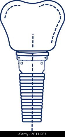 Zahnimplantat Zahn schwarze Linie Symbol. Metallpfosten, der den Wurzelteil eines fehlenden Zahns ersetzt. Piktogramm für Webseite, mobile App, Promo. UI-UX Stock Vektor