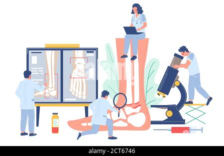 Knöchel- und Fußarthritis. Winzige Arzt Zeichen Untersuchung menschlichen Fußgelenke, flache Vektor-Illustration. Stock Vektor