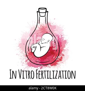 In-vitro-Fertilisation. Knstliche Befruchtung. Petrischale mit  menschlichen Eiern. Reagenzglas mit Sperma Stock-Vektorgrafik - Alamy