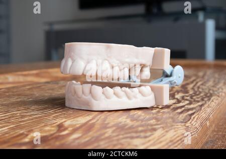 Zähne werden mit dem 3d-Drucker gedruckt. Ober- und Unterkiefer des Erwachsenen. Wird verwendet, um Aligner, Nachtwächter, Zahnspangen, Kronen, Prothesen und chirurgische Führungen zu erstellen. Stockfoto