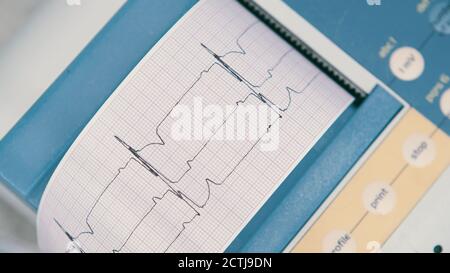 EKG- oder EKG-Diagramm des Elektrokardiographen auf Rasterpapier gedruckt. Hochwertige Fotos Stockfoto