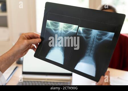 Hand des Arztes mit medizinischer Röntgenaufnahme in der Hand Stockfoto