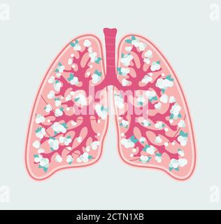 Patientenfreundliches florales Schema von gesunden menschlichen Lungen und Alveolen. Atmungssystem - handgezeichnetes medizinisches Diagramm Stock Vektor