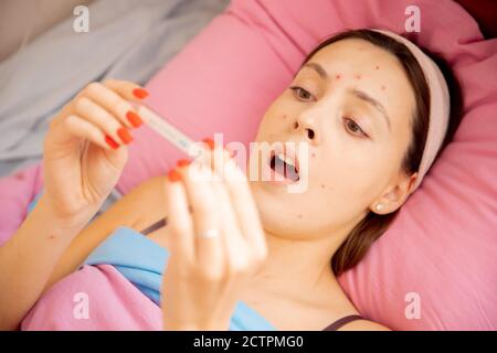 Portrait junge Frau mit Windpocken im Bett liegen und messen Temperatur Stockfoto