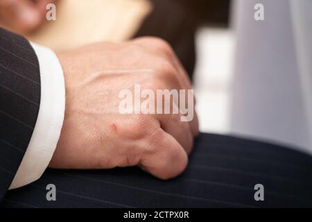 Geschäftlicher Mann, der eine kleine Läsion an der Hand zeigt, unfallverwundete männliche Hand, Wundflecken auf der rechten Seite, kleine Läsion auf der Hand. Stockfoto