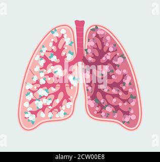 Patientenfreundliches florales Schema von gesunden menschlichen Lungen und Alveolen. Atmungssystem - handgezeichnetes medizinisches Diagramm Stock Vektor