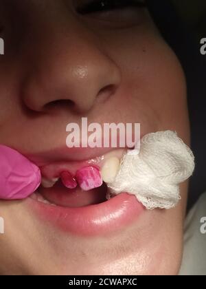Eine junge Patientin, die von einer Zahnhygienikerin behandelt wird Zähne werden poliert Model Release verfügbar Stockfoto
