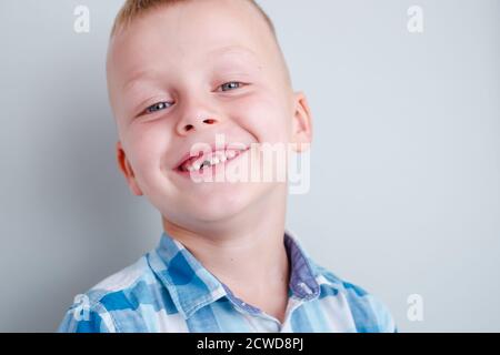 Babylächeln ohne oberen Babyzahn. Ein Loch im Lächeln eines Kindes. Fröhliche Konzept.Gesundheitswesen, Zahnhygiene. Stockfoto