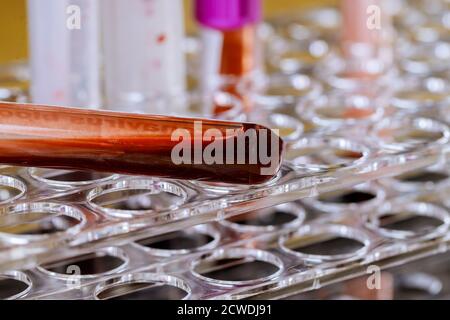 Blutgefäße bereiten für die Gesundheitskontrolle im Labor in der Klinik vor. Stockfoto
