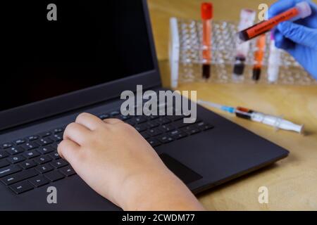 Arzt arbeitet mit Laptop medizinische Geräte Blutprobenschlauch aus Ein Rack mit Analyse im Labortest im Forschungslabor Stockfoto