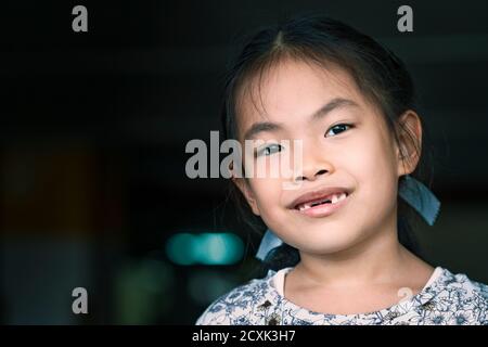 Asiatische Kind Mädchen fehlt Frontzahn, lächelndes Gesicht. Nahaufnahme von niedlichem Gesicht, Platz für Kopie und Design. Augen schauen auf die Kamera. Stockfoto