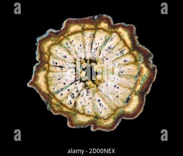 Salzzeder, Tamarix Gallica, TS. Dunkelfeld-Photomikrograph, Schaftabschnitt TS. Stockfoto