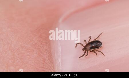 Männliche Hirsch tick auf Nagel der menschlichen Finger Detail. Ixodes ricinus. Nahaufnahme einer kleinen Milbe. Parasit und rosa Haut der Fingerspitze. Enzephalitis, Lyme-Borreliose. Stockfoto