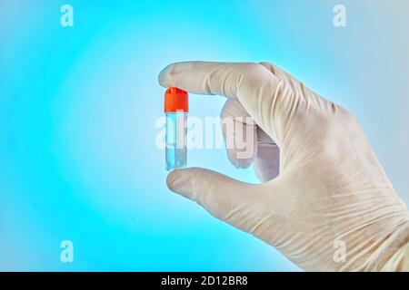 DNA-Test. Der Arzt hält ein Reagenzglas mit Flüssigkeit für die DNA-Analyse im Labor. Stockfoto