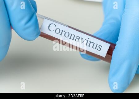 Weibliche Hände in blauen Handschuhen halten ein Blutgefäß mit den Worten Coronavirus vor sich. Konzept der Medizin, Analyse Stockfoto
