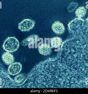 1918 H1N1-Viruspartikel Elektronenmikrographie von 1918 H1N1-Grippeviruspartikeln in der Nähe einer Zelle. Kredit: NIAID. AMT Kamerasystem4/5/2018 16:48 68000 Stockfoto