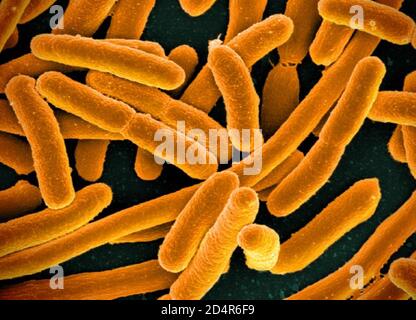 Farbige Rasterelektronenmikrographie (SEM), Escherichia coli sind Gram-negative stabförmige Bakterien, die Teil der normalen Flora des menschlichen Darms sind Stockfoto