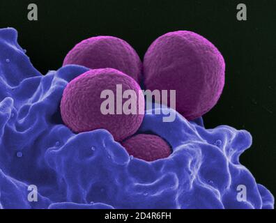 Methicillin-resistenter Staphylococcus aureus (MRSA) Rasterelektronenmikroskopische Aufnahme eines menschlichen Neutrophils, das MRSA (Purple) aufsauge. Stockfoto