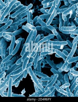Mycobacterium tuberculosis bacteria Scanning Electron micrograph of Mycobacterium tuberculosis bacteria bacteria, which cause Kredit: NIAID ; Cré Stockfoto