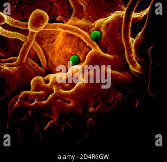 MERS-CoV-Partikel auf Kamelepithelzellen; particulules MERS-CoV sur des cellules épithéliales de chameau Stockfoto