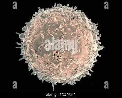 Humane B-Lymphozyte Koloriertes Rasterelektronenmikrograph einer B-Zelle eines menschlichen Spenders. Kredit: NIAID ; Crédits: NIAID Stockfoto