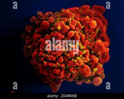 HIV-infizierte H9-T-Zelle Scanning-Elektromikrographie einer HIV-infizierten H9-T-Zelle. Kredit: NIAID ; Crédits: NIAID Stockfoto