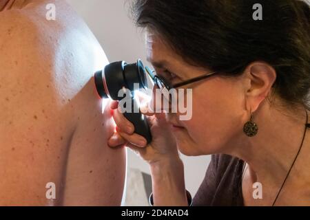 Hautarzt untersucht die Haut eines Patienten mit einem Dermatoskop. Stockfoto