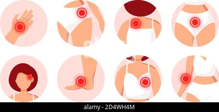 Vektorsymbole mit Körperverletzungen auf weißem Hintergrund isoliert. Erste Hilfe bei Trauma, Prellung oder Fraktur. Flache Lay-Optik. Vektorgrafik Stock Vektor