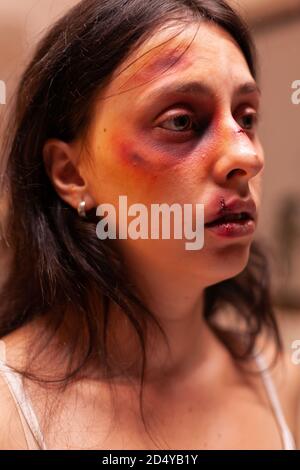 Frau in Schmerzen, nachdem sie von einem furchteinflößenden Geliebten misshandelt und traumatisiert wurde. Gewalttätiger aggressiver Ehemann missbraucht Verletzungen verängstigt hilflos, verletzlich, ängstlich, geschlagen und in Panik versetzt Frau. Stockfoto