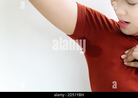 Frau mit Hyperhidrose schwitzen. Junge Asien Frau mit Schweiß Fleck auf ihrem Unterarm Kleidung. Healthcare Konzept Stockfoto