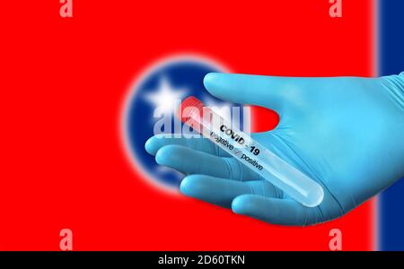 Prüfung auf Vorhandensein von Coronavirus. Röhrchen mit einer Tupfer-Probe, die positiv auf COVID-19 getestet wurde. Flagge des Bundesstaates Tennessee im Hintergrund. Stockfoto