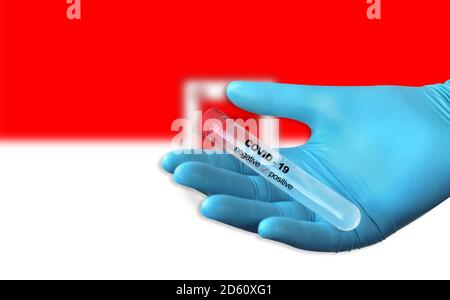 Prüfung auf Vorhandensein von Coronavirus. Röhrchen mit einer Tupfer-Probe, die positiv auf COVID-19 getestet wurde. Vorarlberger Flagge im Hintergrund. Stockfoto