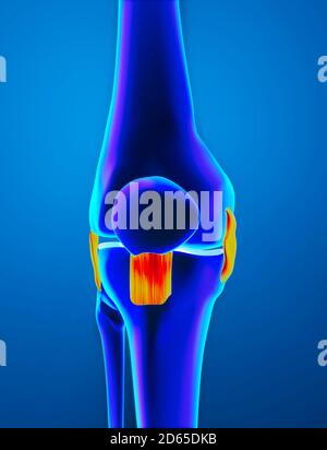 Entzündung, verstauchte Kniebänder. Oberschenkel, Schnalle und Patella von vorne gesehen. Röntgenansicht, Anatomie, Knochen, menschlicher Körper. 3d-Rendering Stockfoto