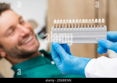 Farbmuster der Zähne in der Palette zur Bestimmung des Schattens über den Zähnen des Patienten. Der Stomatologe verwendet die Farbe der Zähne, um Veneers, Kronen und Prothesen zu machen Stockfoto